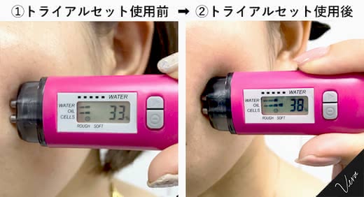 ブライトエイジ口コミ人気ランキングおすすめ効果