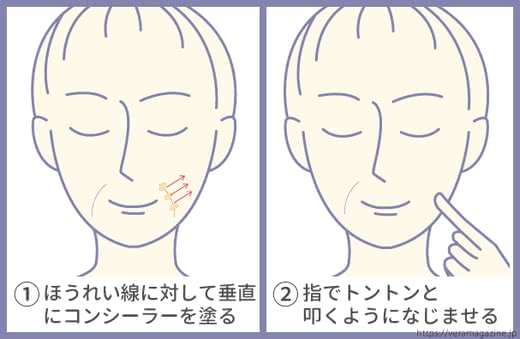 ほうれい線原因