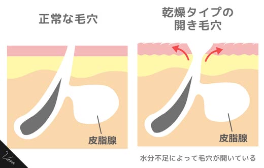 毛穴化粧水