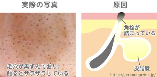 毛穴クレンジング