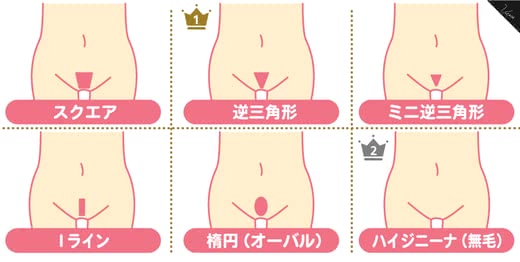 VIO 医療脱毛