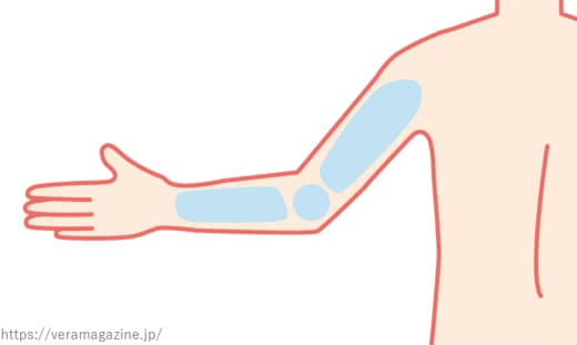 脱毛サロン効果
