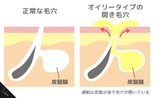 毛穴化粧水