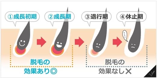 全身脱毛