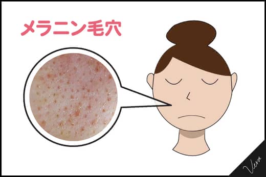 毛穴化粧品