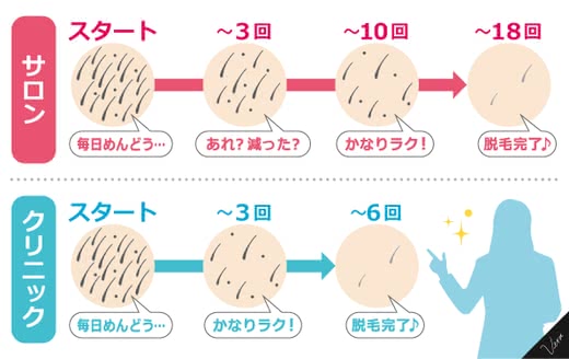 背中脱毛