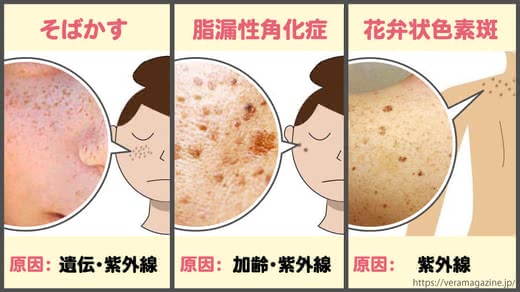 シミ消す