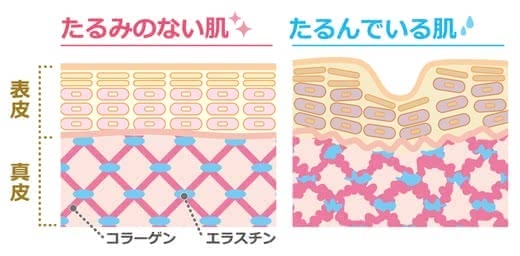 目の下のたるみ解消法