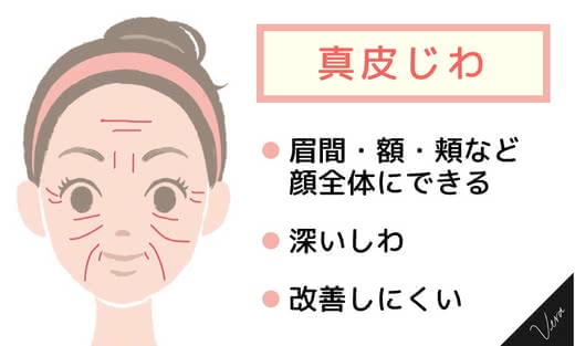 小じわクリーム