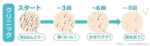 医療,全身,脱毛
