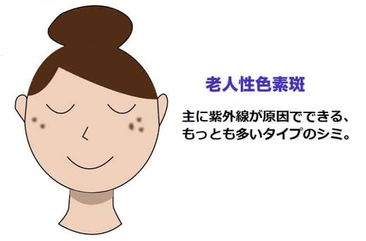 シミ美白美容液人気おすすめランキング