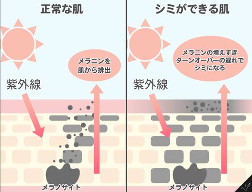 シミ化粧品人気おすすめランキング