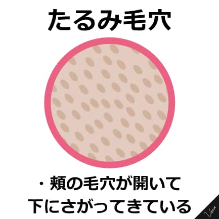 毛穴開き人気おすすめランキング