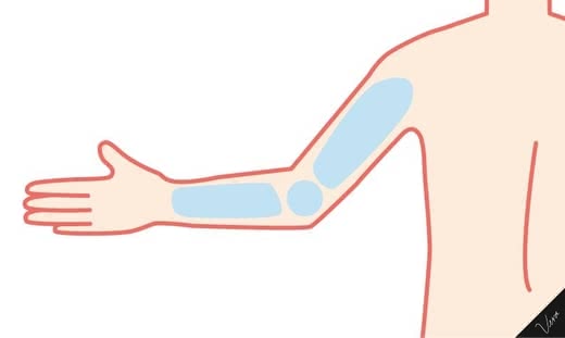 脱毛サロン効果