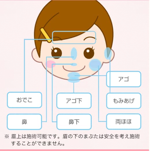 キレイモ口コミ