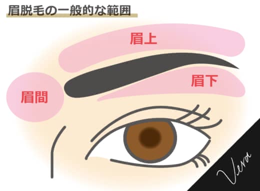 眉毛脱毛おすすめ人気ランキングサロンクリニック