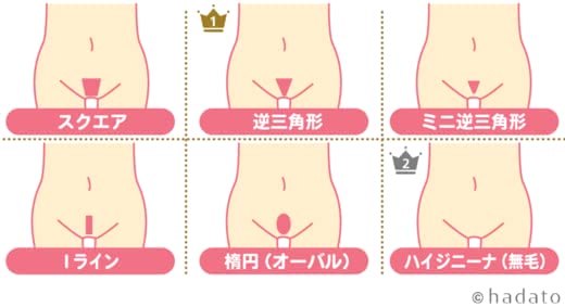 VIO 医療脱毛