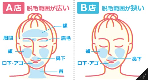 顔脱毛