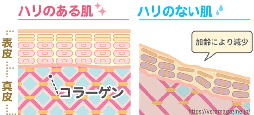 ほうれい線原因