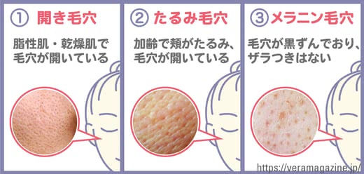 毛穴化粧水