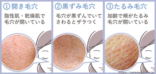 毛穴乳液