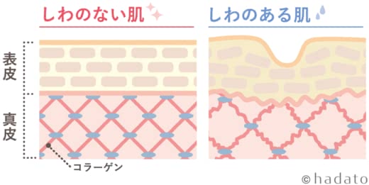 リンクルクリームシワ改善効果口コミ