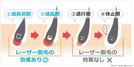 医療脱毛回数