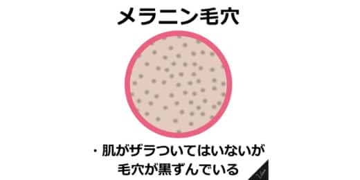 毛穴洗顔黒ずみおすすめ人気ランキング