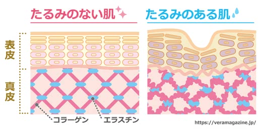 顔のたるみの改善法