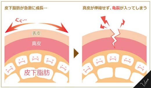 妊娠24週のママ