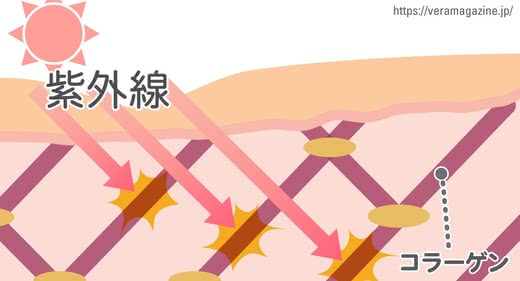 ほうれい線原因